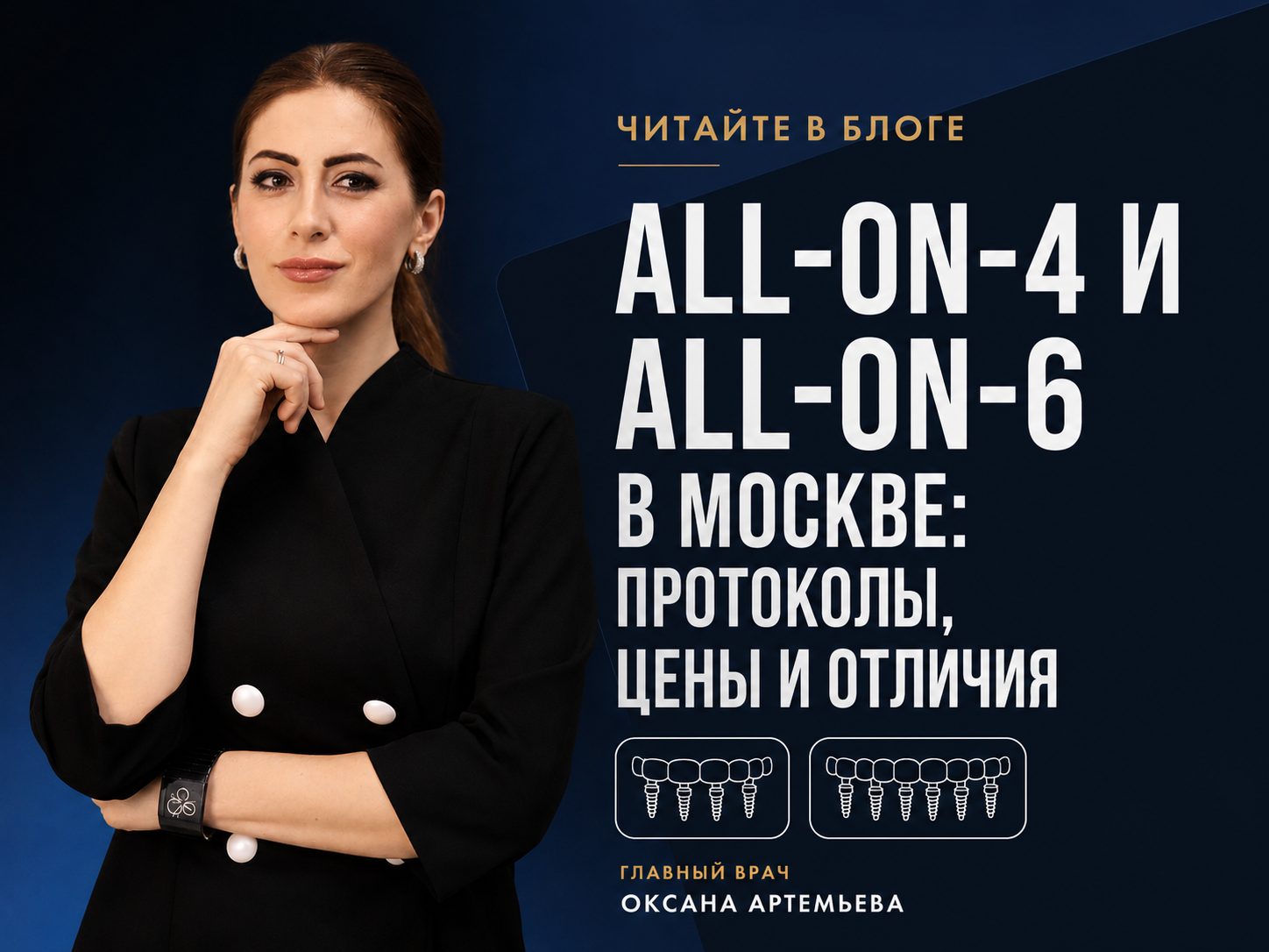 All-on-4 и All-on-6 в Москве: протоколы, цены и отличия